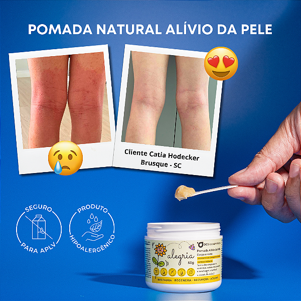 Pomada Alívio da Pele ALEGRIA | 50g