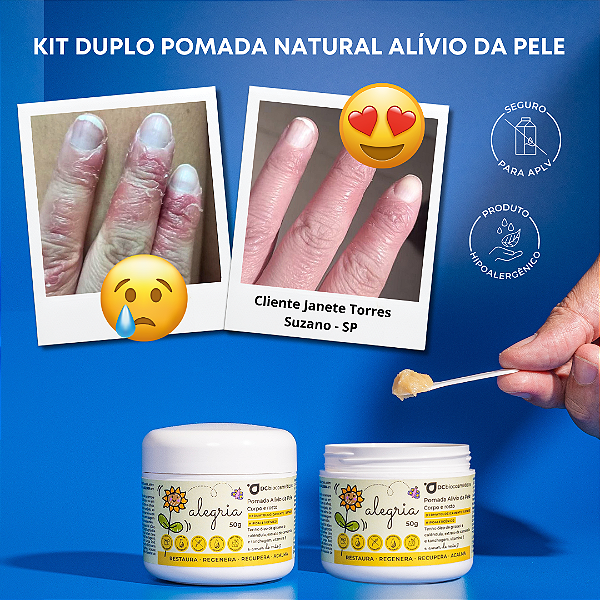 Kit Duplo Pomada ALEGRIA