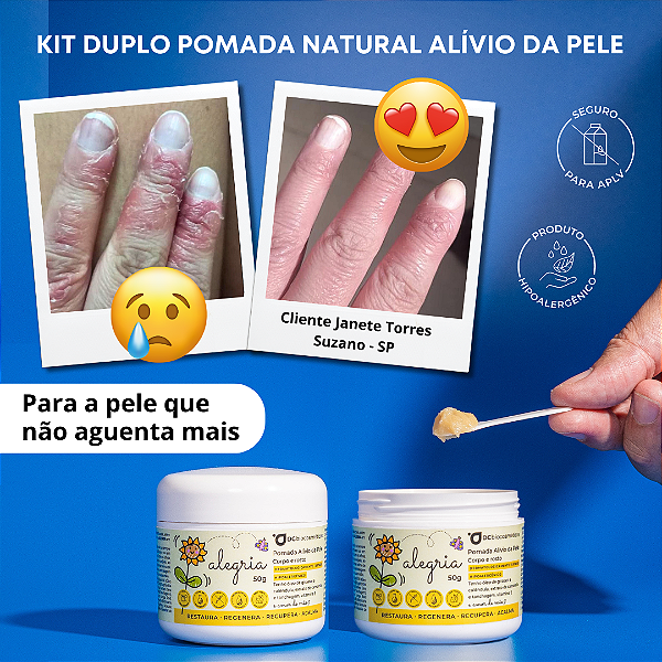 Kit Duplo Pomada ALEGRIA