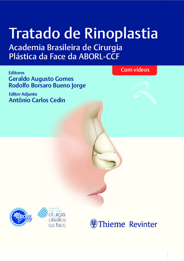 Livro Tratado de Rinoplastia: Academia Brasileira de Ciru...