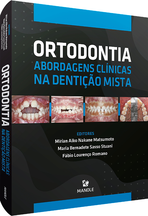Ortodontia - Abordagens clínicas na dentição mista
