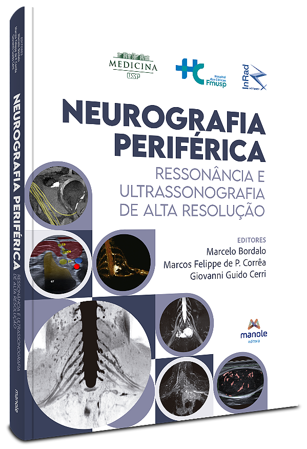 Livro Neurografia periférica: Ressonância e ultrassonogra...