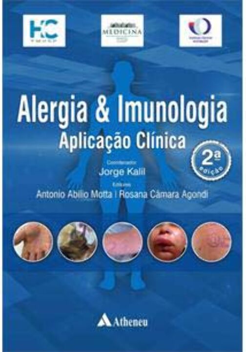 Livro Alergia e imunologia – Aplicação clínica