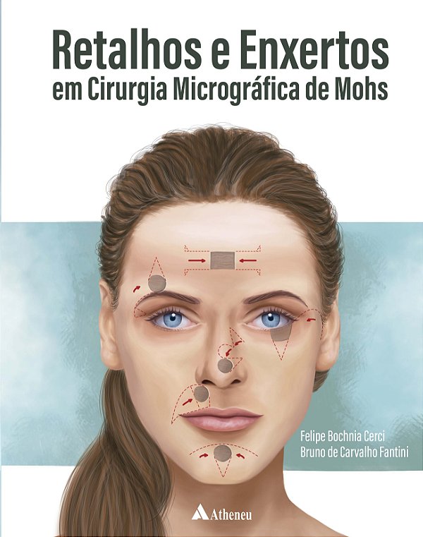 Livro Retalhos e enxertos em cirurgia micrográfica de Mohs