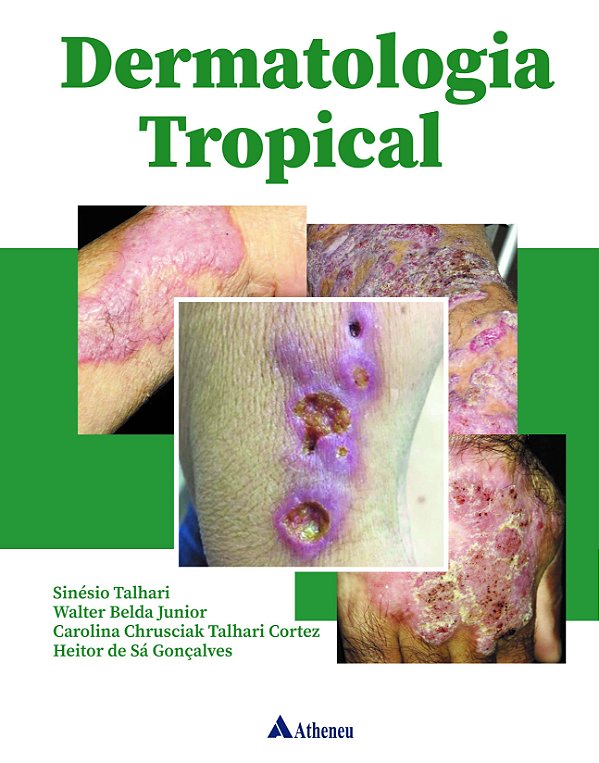 Livro Dermatologia tropical