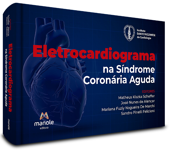 Livro Eletrocardiograma na síndrome coronária aguda
