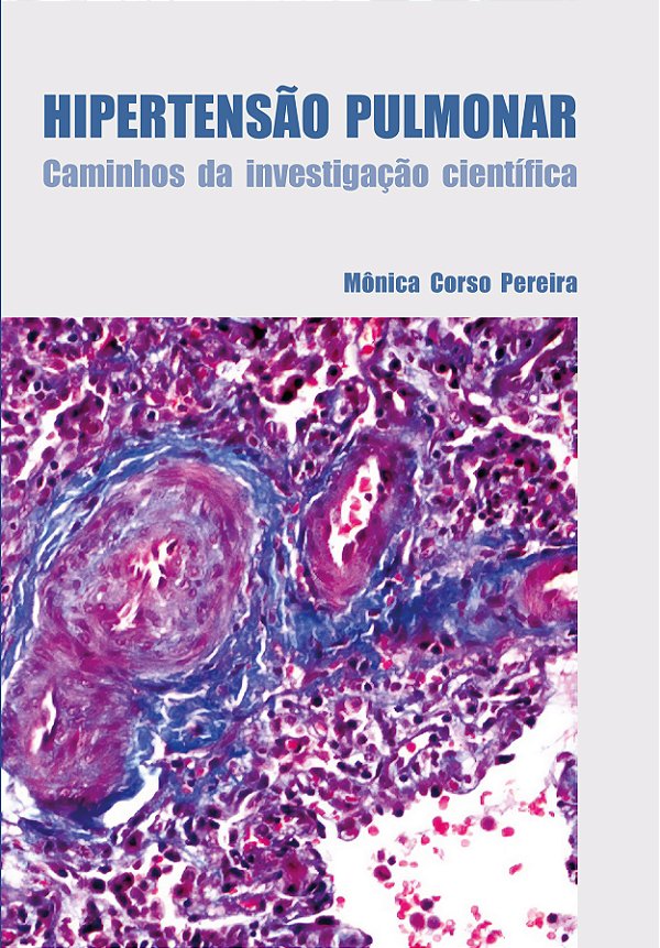 Livro Hipertensão Pulmonar - Caminhos Da Investigação Científic...