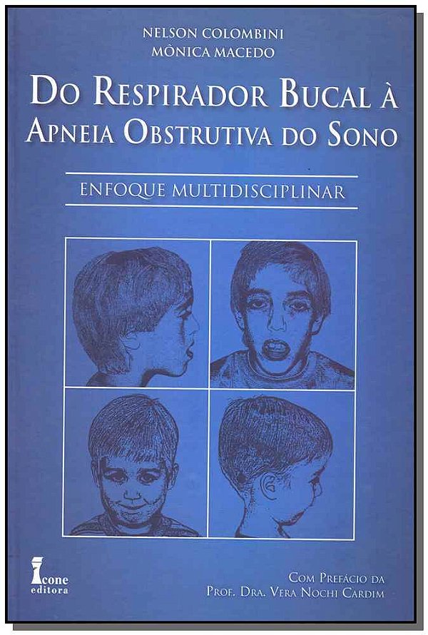 Livro Do Respirador Bucal À Apneia Obstrutiva Do Sono