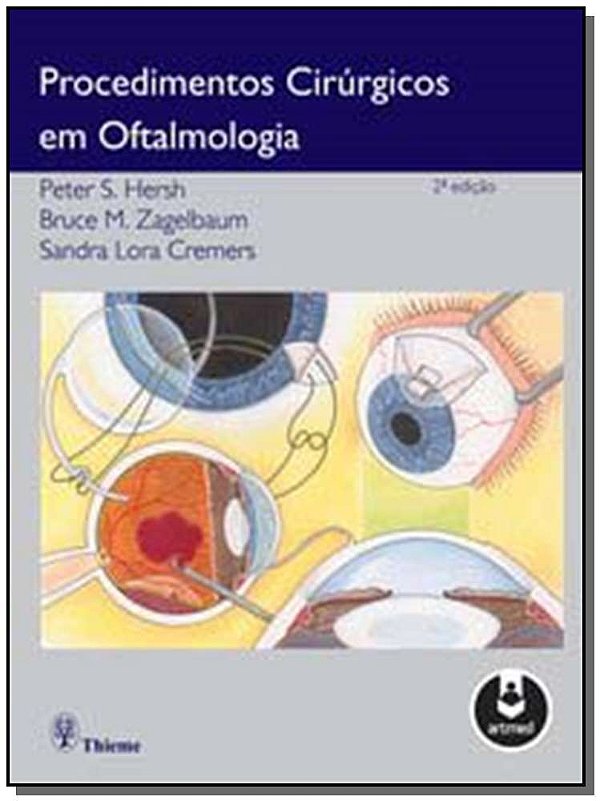 Livro Procedimentos Cirúrgicos em Oftalmologia