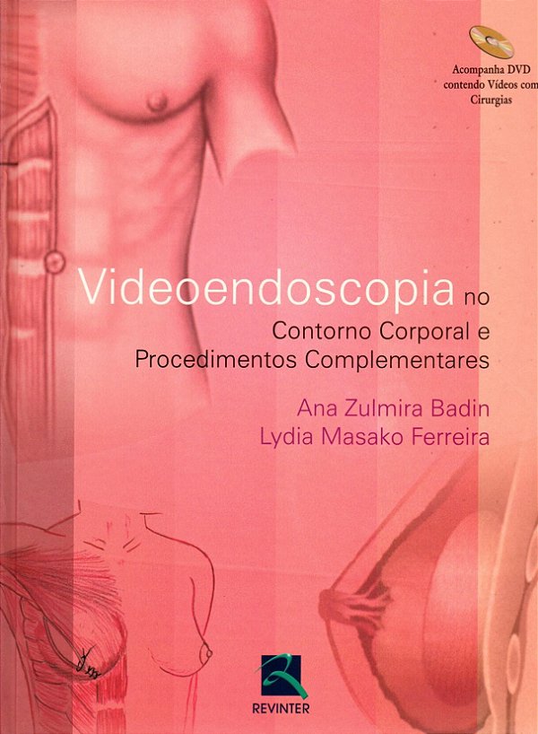 Livro Vídeoendoscopia No Contorno Corporal E Procedimento...