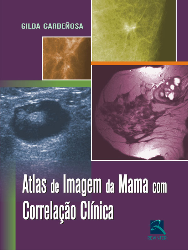 Livro Atlas De Imagem Da Mama Com Correlação Clínica
