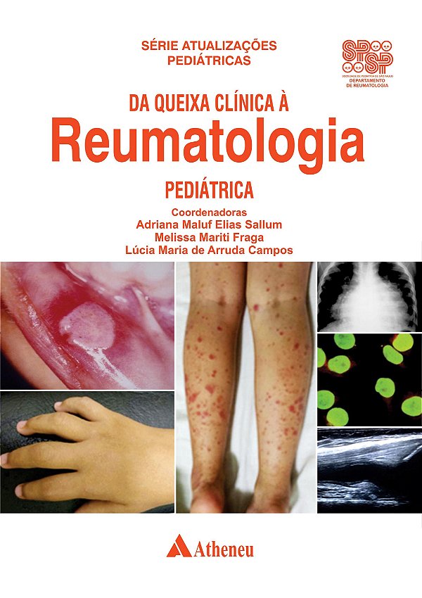 Livro Da queixa clínica à reumatologia pediátrica
