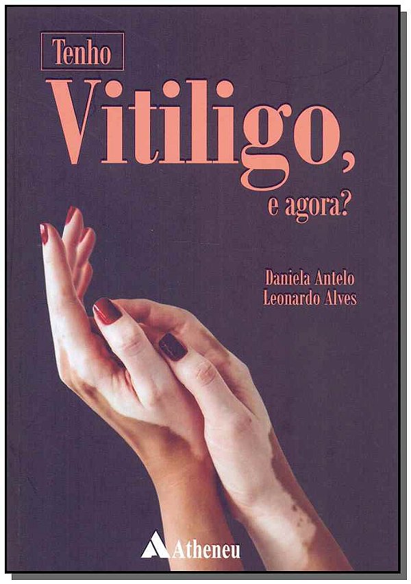 Livro Tenho vitiligo, e agora?