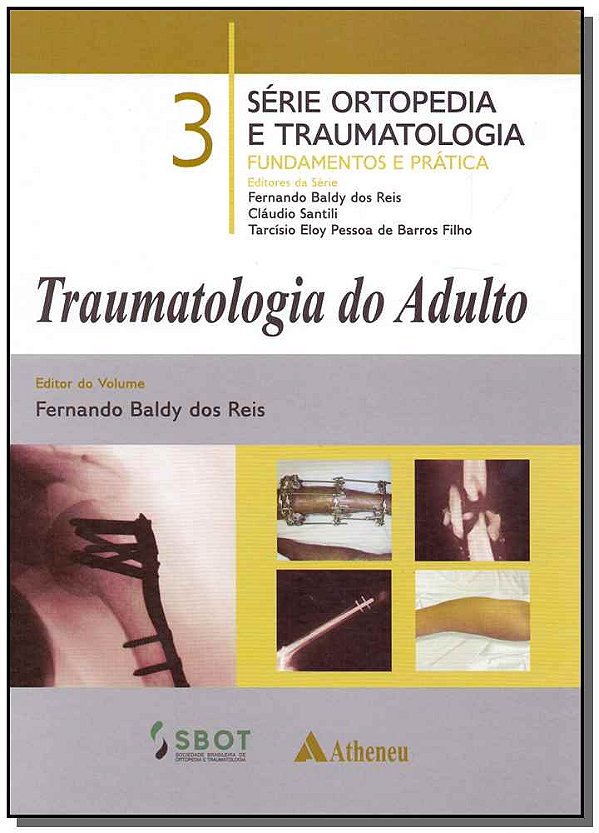 Livro Traumatologia do adulto