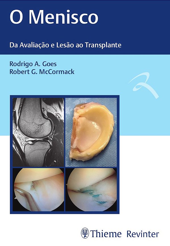 Livro O menisco: da avaliação e lesão ao transplante