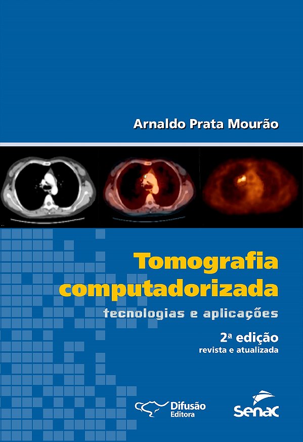 Livro Tomografia computadorizada: tecnologias e aplicaçõe...