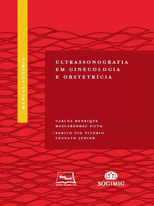 Livro Manual Sogimig - Ultrassonografia Em Ginecologia E ...