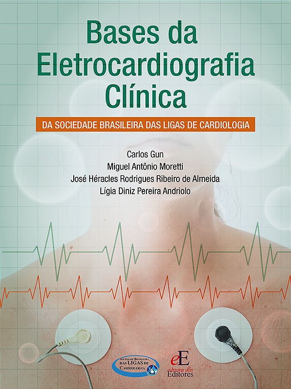 Livro Bases Da Eletrocardiografia Clínica - Da Sociedade ...