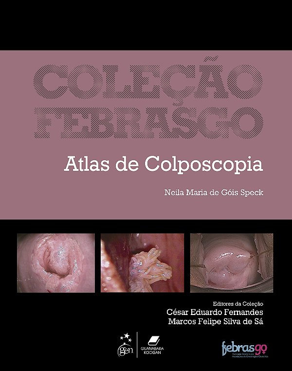Livro Coleção Febrasgo - Atlas de colposcopia