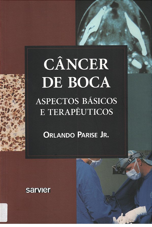 Câncer De Boca