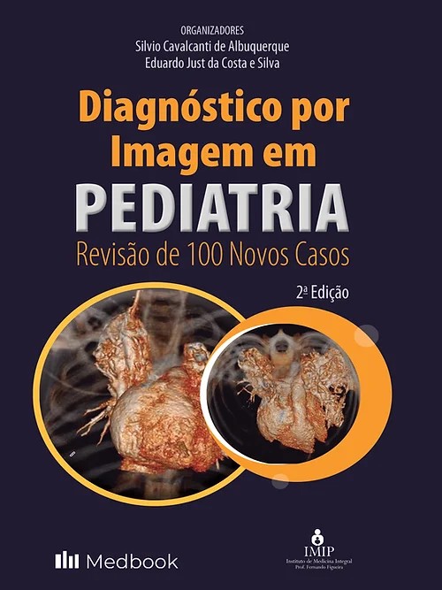 Diagnostico Por Imagem Em Pediatria: Revisão De 100 Novos Casos - 02Ed/22