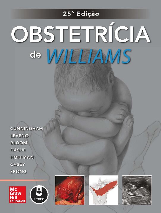 Livro Obstetrícia de williams