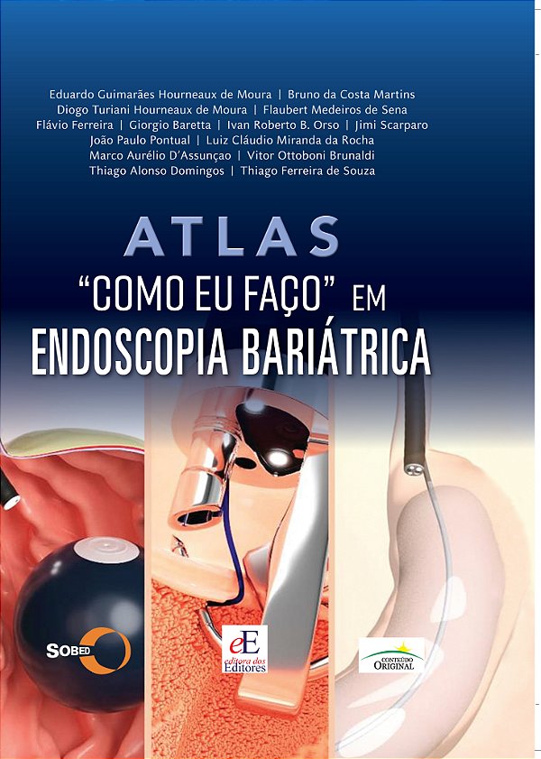 Atlas "Como Eu Faço " em Endoscopia Bariatrica
