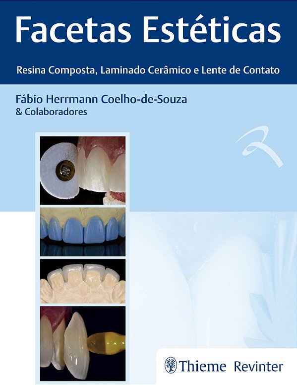 Facetas Estéticas: Resina Composta, Laminado Cerâmico e Lente de Contato