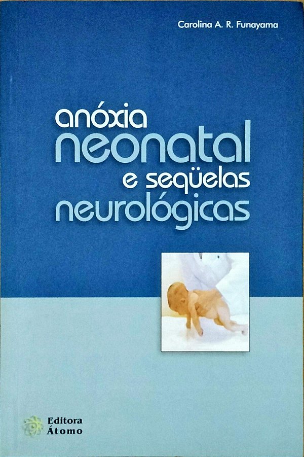Anoxia Neonatal E Sequelas Neurologicas - 1