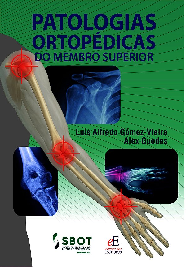 Patologias Ortopédicas do Membro Superior