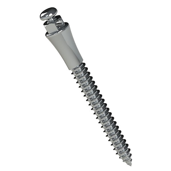 Miniparafuso ortodôntico - Aço