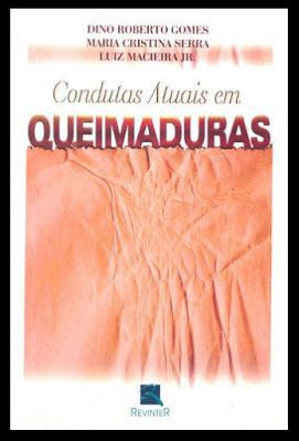 QUEIMADURAS