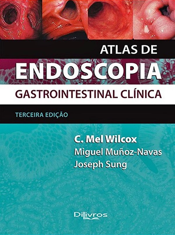 Atlas De Endoscopia Gastrointestinal Clínica - Terceira Edição