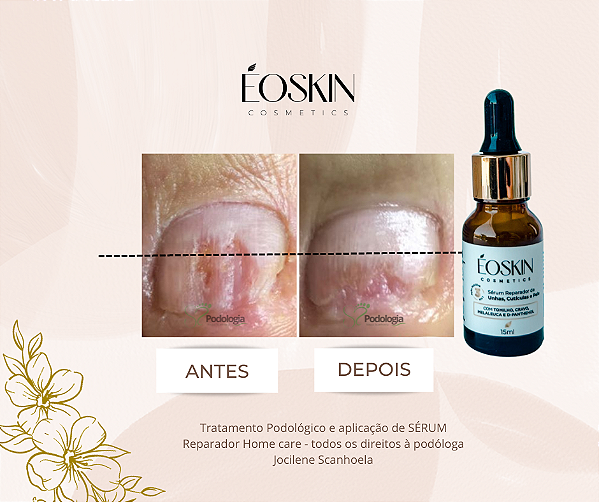 COMBO COM 10 UNIDADES - SERUM REPARADOR DE UNHAS EOSKIN - 15 ml