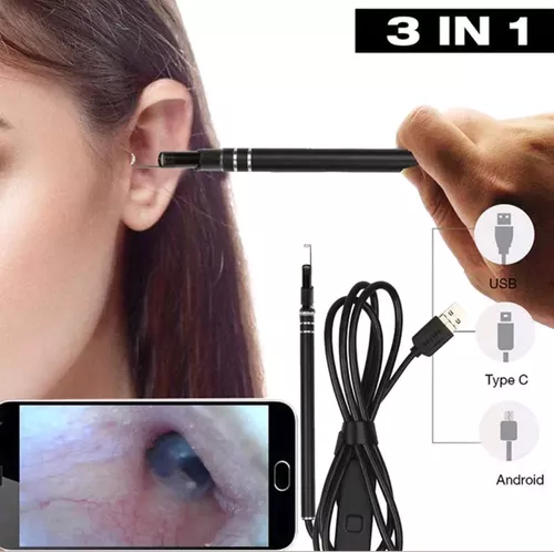 Otoscópio Digital Veterinário com Conexão USB