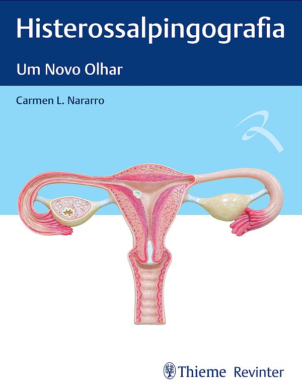 Histerossalpingografia Um Novo Olhar..-