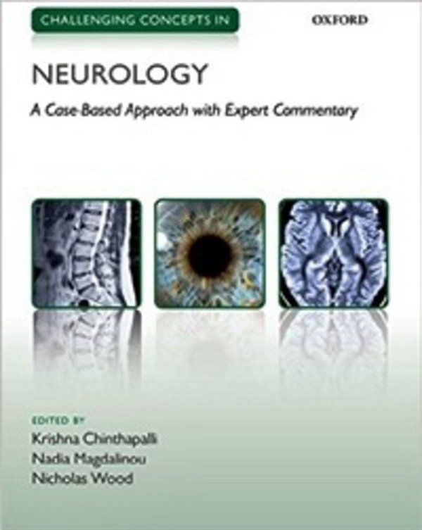 Challenging Concepts In Neurology - Cases With Expert Commentary