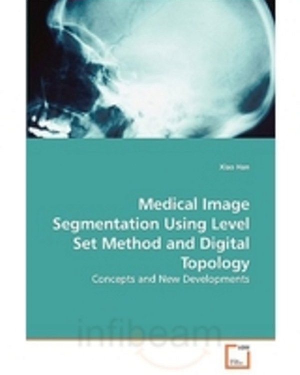 Medical Image Segmentation Using Level Set Method And Digital Topology-..