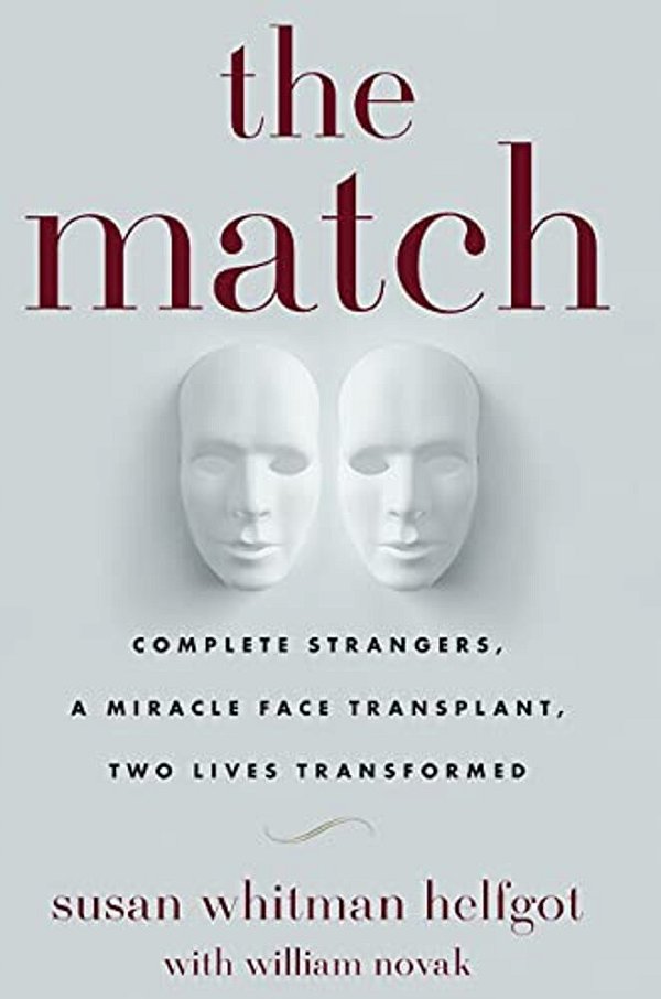 The Match: Complete Strangers, A Miracle Face Transplant, Two Lives Transformed-..