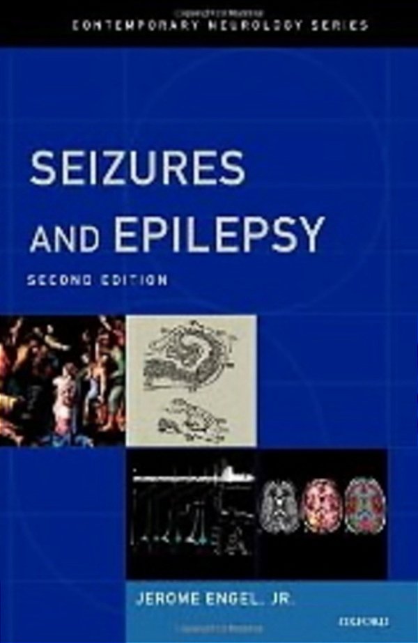 Seizures And Epilepsy-..