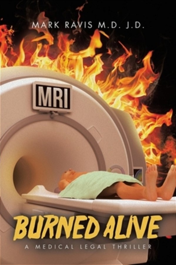 Burned Alive: A Medical Legal Thriller-..
