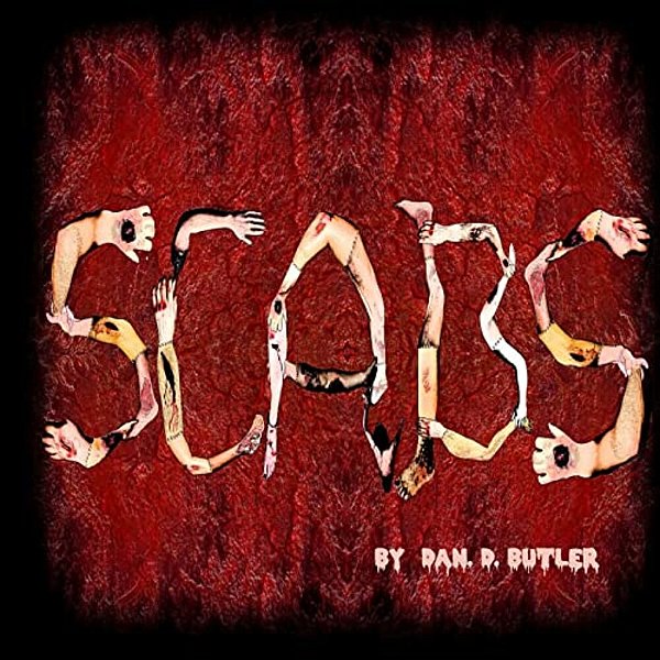Scabs: Picking Apart The Facts-..