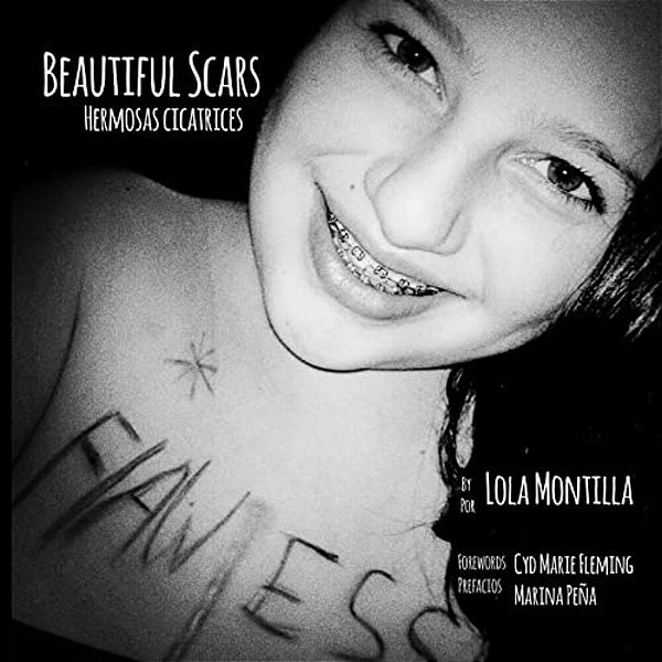 Beautiful Scars Hermosas Cicatrices-..