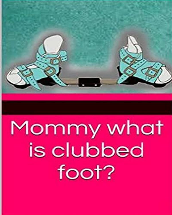 Mommy What Is Clubbed Foot?-..