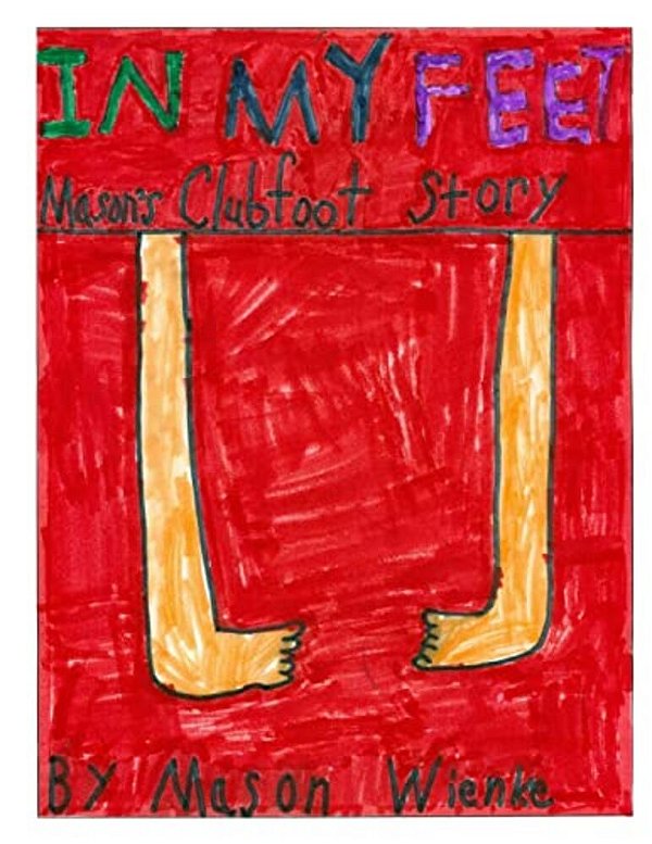In My Feet: Mason's Clubfoot Story-..