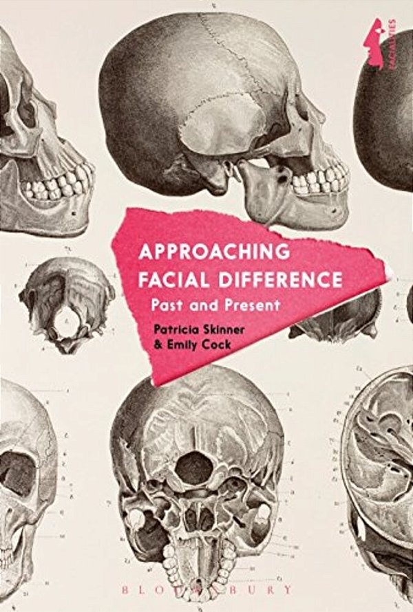 Approaching Facial Difference: Past And Present-..