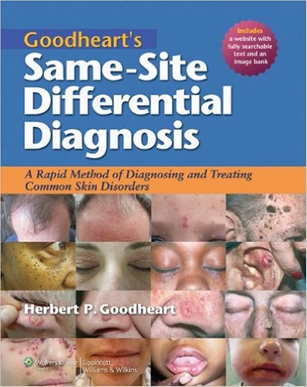 Goodheart's Same-Site Differential Diagnosis - A Rapid Method Diagnosing Treat. Common Skin Disorders-..