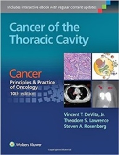 Cancer Of The Thoracic Cavity - Cancer, Principles & Practice Of Oncology - 10Th Edition-..