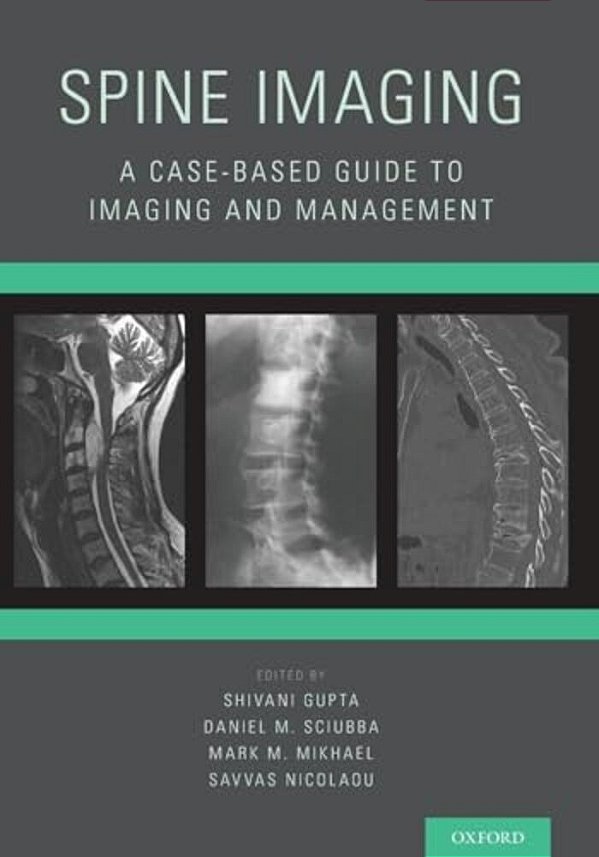 Spine Imaging: A Case-Based Guide To Imaging And Management-..