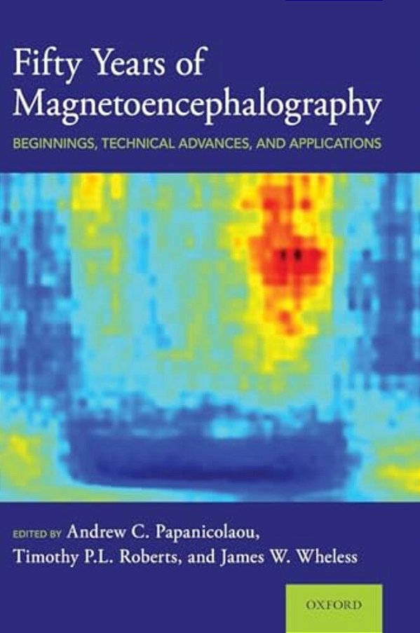 Fifty Years Of Magnetoencephalography: Beginnings, Technical Advances, And Applications-..